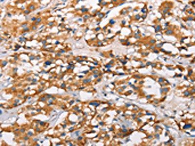 MARC1 Antibody