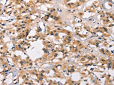MARC1 Antibody