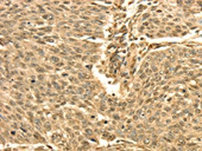 SEPT2 Antibody