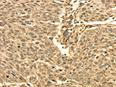 43345 antibody