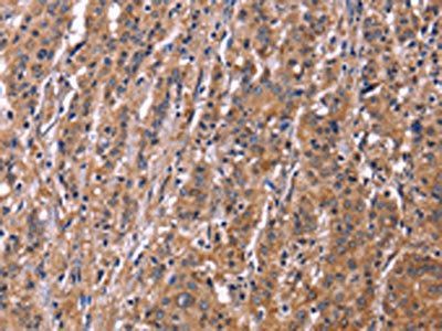 SEPT7 Antibody