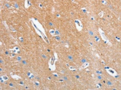 SEPT9 Antibody