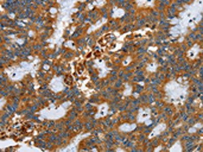 SEPT9 Antibody