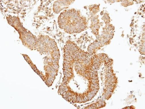 SEPT7 antibody [N3C3]