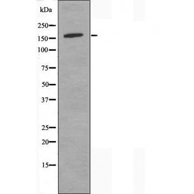 Collagen IV Alpha2 antibody
