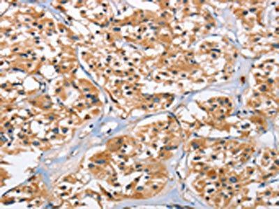 EIF4EBP2 Antibody