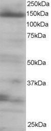 Goat anti-4E-T / EIF4ENIF1 Antibody