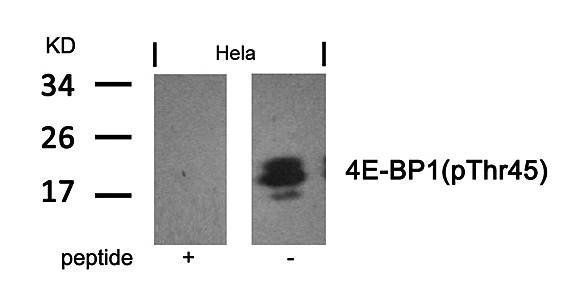 4E-BP1 (Phospho-Thr46) Antibody
