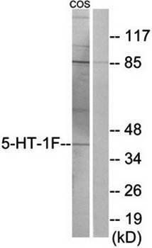 5-HT-2B antibody