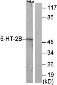 5-HT-3A antibody