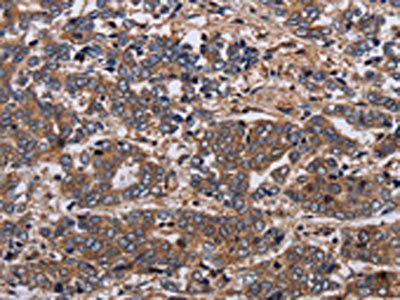 HTR2B Antibody