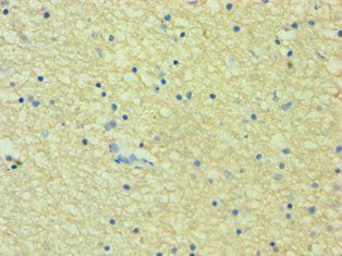 HTR2B Antibody