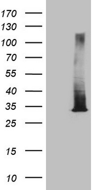 5 Lipoxygenase (ALOX5) antibody