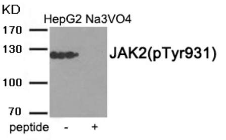 JAK2 (Phospho-Tyr931) Antibody [Out of stock]