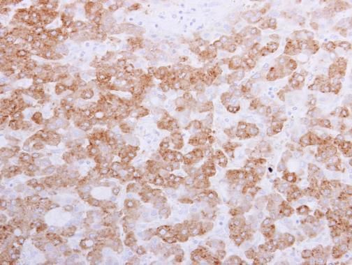 58K Golgi protein antibody [N1N3]