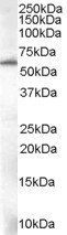 Goat anti-58KGolgi protein(Internal)/FTCD Antibody