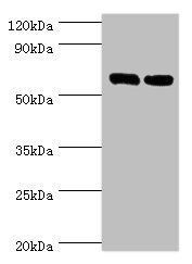 60 kDa SS-A/Ro ribonucleoprotein antibody