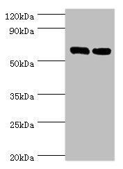 TROVE2 Antibody