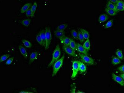 60S acidic ribosomal protein P1 antibody