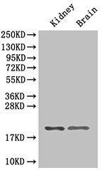 60S ribosomal protein L11 antibody