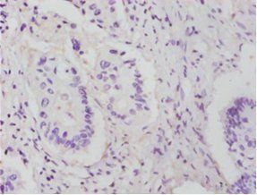 RPL14 Antibody