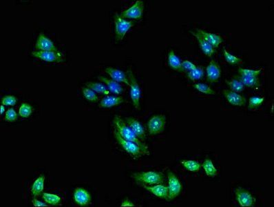 60S ribosomal protein L28 antibody