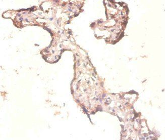 60S ribosomal protein L3 antibody