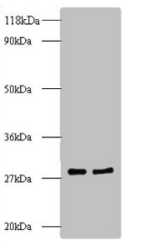 60S ribosomal protein L8 antibody