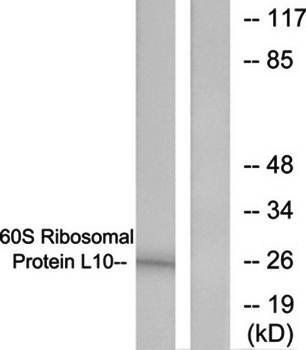60S Ribosomal Protein L10 antibody