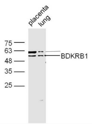 BDKRB1 antibody