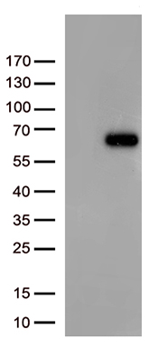 67kDa Laminin Receptor antibody