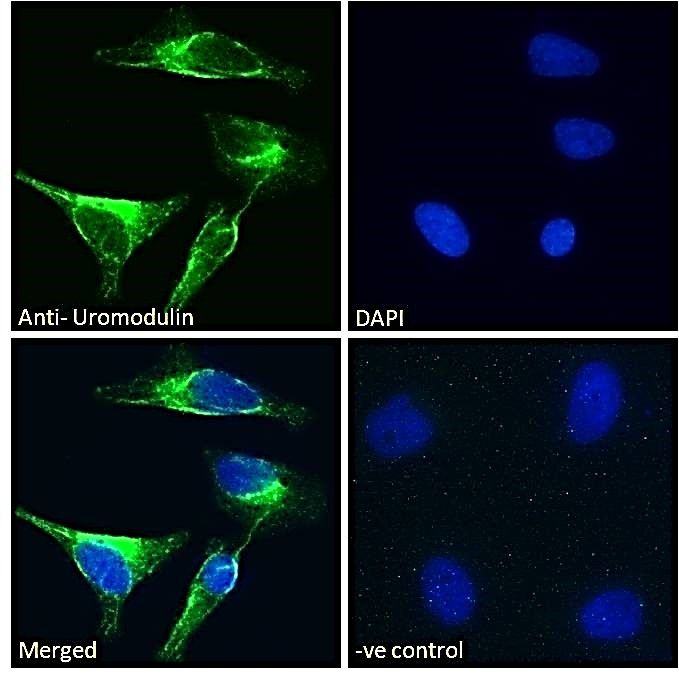 Uromodulin antibody