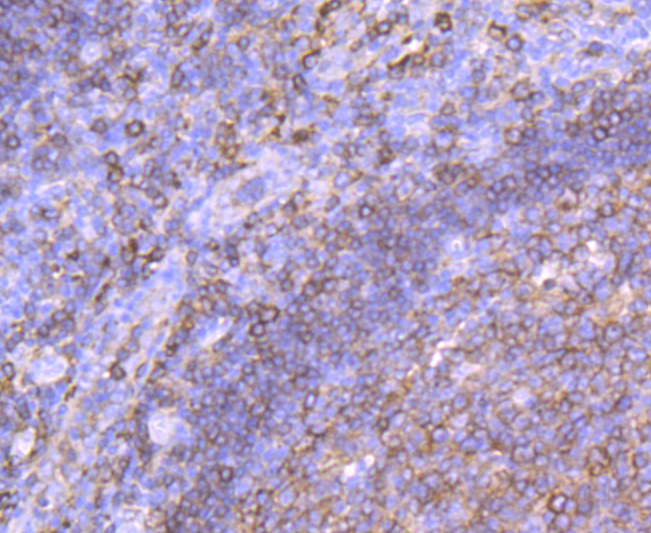 HLA-DPB1 polyclonal antibody