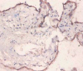 HSPA5 Antibody