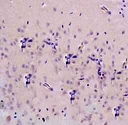 8-OHdG (DNA/RNA Damage) antibody