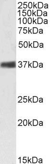 Goat anti-Nucleophosmin / NPM1 Antibody