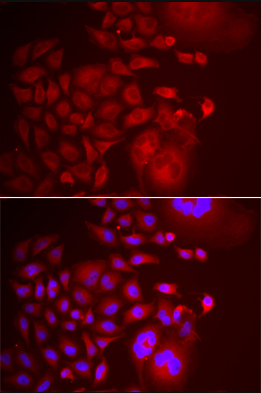 TRAPPC10 antibody