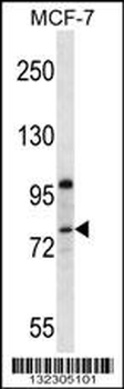 PR15B Antibody (C-term)