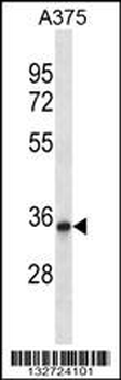 DYSFIP1 Antibody (N-term)