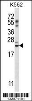 PSORS1C1 Antibody (N-term)