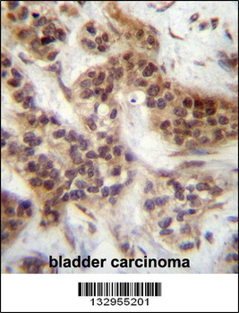 FOXA2 Antibody (Center T156)