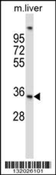 UPRT Antibody (C-term)