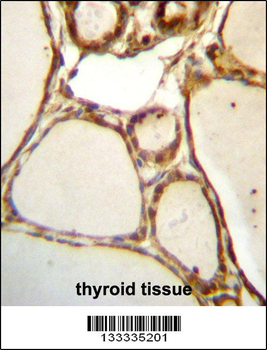 HJURP Antibody (C-term)