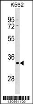 POU5F2 Antibody (Center)