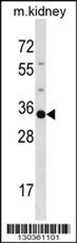 POU5F2 Antibody (Center)