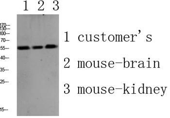 PLD4 Polyclonal Antibody