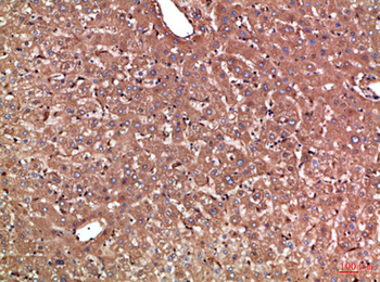 Haptoglobin Polyclonal Antibody