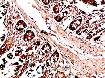 HLA-DQA1 Polyclonal Antibody