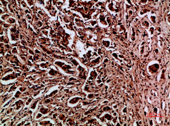 HDGF Polyclonal Antibody