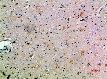 CCL14 Polyclonal Antibody